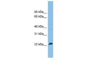 WB Suggested Anti-SPATA24 Antibody Titration: 0.
