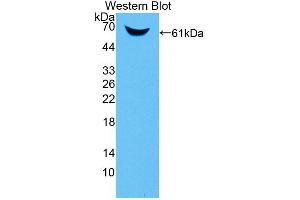 Figure. (ANKRD1 antibody  (AA 5-279))