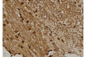 ABIN6273461 at 1/100 staining Mouse brain tissue by IHC-P. (CENPM antibody  (Internal Region))