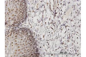 Immunoperoxidase of  purified  MaxPab antibody to RNF32 on formalin-fixed paraffin-embedded human esophagus. (RNF32 antibody  (AA 1-256))