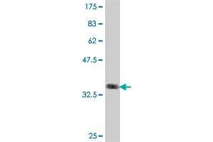 Western Blot detection against Immunogen (36. (PRP19 antibody  (AA 1-90))