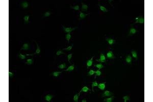 Immunofluorescence staining of A549 cells with ABIN7171058 at 1:100, counter-stained with DAPI. (SMARCC2 antibody  (AA 300-650))