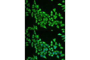 Immunofluorescence analysis of HeLa cell using MRPS30 antibody. (MRPS30 antibody)