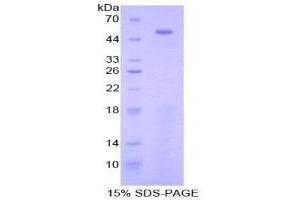 SDS-PAGE (SDS) image for Toll-Like Receptor 3 (TLR3) (AA 727-905) protein (His tag,GST tag) (ABIN2123681)
