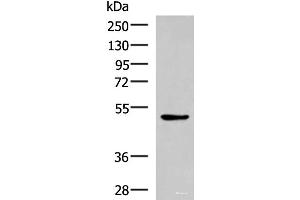 Western blot analysis of LOVO cell lysate using BLNK Polyclonal Antibody at dilution of 1:600 (B-Cell Linker antibody)