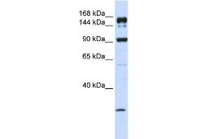 ABCA5 antibody used at 1 ug/ml to detect target protein. (ABCA5 antibody)