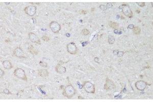 Immunohistochemistry of paraffin-embedded Rat brain using GANAB Polyclonal Antibody at dilution of 1:150 (40x lens). (GANAB antibody)