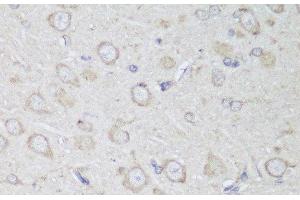 Immunohistochemistry of paraffin-embedded Rat brain using GANAB Polyclonal Antibody at dilution of 1:150 (40x lens).