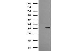 Western Blotting (WB) image for anti-T-cell surface glycoprotein CD1c (CD1C) antibody (ABIN2670671) (CD1c antibody)