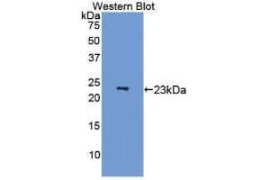 Western blot analysis of the recombinant protein. (MAP4 antibody  (AA 882-1062))