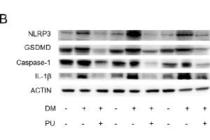 anti-Interleukin 1, beta (IL1B) (AA 1-269) antibody