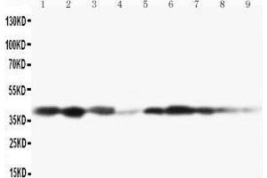 Lane 9: COLO320 Cell Lysate (MAP2K3 antibody  (C-Term))