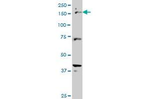 CUTL1 monoclonal antibody (M02), clone 2D10 Western Blot analysis of CUTL1 expression in Hela S3 NE . (CUX1 antibody  (AA 521-620))