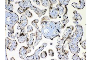 Immunohistochemistry (IHC) image for anti-X-Ray Repair Complementing Defective Repair in Chinese Hamster Cells 1 (XRCC1) (AA 538-633) antibody (ABIN5693138)