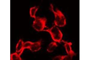 ABIN6267337 staining 293 by IF/ICC. (IGF1R antibody  (pTyr1161))
