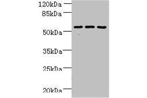 Western blot All lanes: ZNF19 antibody at 4 μg/mL Lane 1: Mouse liver tissue Lane 2: MDA-MB-231 whole cell lysate Lane 3: HepG2 whole cell lysate Secondary Goat polyclonal to rabbit IgG at 1/10000 dilution Predicted band size: 53, 52 kDa Observed band size: 53 kDa (ZNF19 antibody  (AA 1-200))