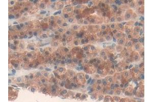 Immunohistochemistry (IHC) image for anti-Fatty Acid Synthase (FASN) (AA 2243-2505) antibody (ABIN7434944)