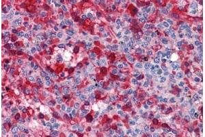 Human Spleen: Formalin-Fixed, Paraffin-Embedded (FFPE) (WDR20 antibody  (AA 1-570))