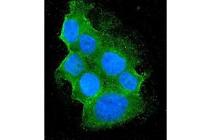 IF analysis of Bid using anti-Bid antibody (ABIN7599062). (BID antibody  (AA 1-195))