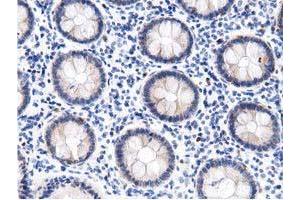 Immunohistochemical staining of paraffin-embedded Human colon tissue using anti-DNAJA2 mouse monoclonal antibody. (DNAJA2 antibody)