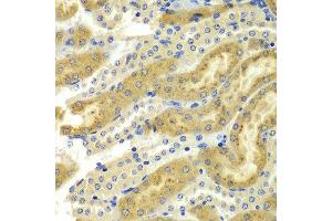 Immunohistochemistry of paraffin-embedded mouse kidney using PAK2 antibody at dilution of 1:100 (x400 lens).