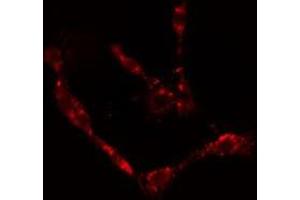 ABIN6277081 staining  HepG2 cells by IF/ICC. (NGFR antibody  (Internal Region))