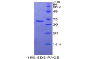 SDS-PAGE (SDS) image for Neurofascin (NFASC) (AA 760-1007) protein (His tag) (ABIN2121756)