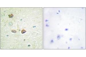 Immunohistochemistry analysis of paraffin-embedded human brain tissue, using 5-HT-1B Antibody. (5HT1B Receptor antibody  (AA 201-250))