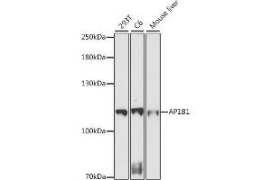 Western blot analysis of extracts of various cell lines, using B1 antibody (ABIN7265445) at 1:1000 dilution.
