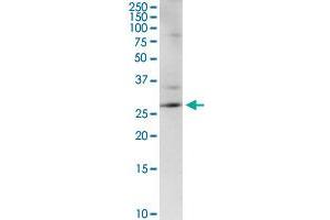 CENPH MaxPab rabbit polyclonal antibody. (CENPH antibody  (AA 1-247))