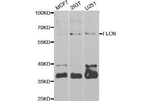 Western blot analysis of extracts of various cell lines, using FLCN antibody (ABIN5973885) at 1/1000 dilution.