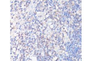 Immunohistochemistry of paraffin-embedded Human appendix using CFL1 Polyclonal Antibody at dilution of 1:100 (40x lens). (Cofilin antibody)