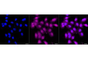 Immunocytochemical staining of HepG2 cells with PPP1CA + 1CB antibody (ABIN7799892), 1:1,000).