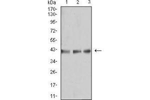Western blot analysis using B3GAT1 mouse mAb against MOLT4 (1), Raji (2), and Ramos (3) cell lysate.