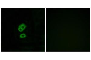 Immunofluorescence analysis of MCF-7 cells, using OR2T10 antibody.