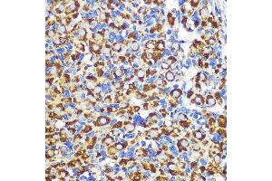 Immunohistochemistry of paraffin-embedded Rat ovary using FGF2 Rabbit pAb (ABIN3020744, ABIN3020745, ABIN3020746 and ABIN6213702) at dilution of 1:100 (40x lens). (FGF2 antibody  (AA 143-288))