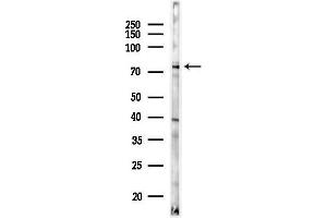 Western blot analysis of lysates from Rat brain, using SLC5 Antibody at 1/1000 dilution.