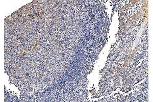 IHC analysis of GFPT1 using anti-GFPT1 antibody (ABIN7602887).