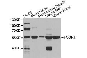 Western blot analysis of extracts of various cell lines, using FCGRT antibody (ABIN5995932) at 1/1000 dilution. (FcRn antibody)