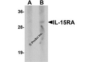 Western Blotting (WB) image for anti-Interleukin 15 Receptor, alpha (IL15RA) antibody (ABIN1077442) (IL15RA antibody)