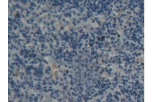 DAB staining on IHC-P; Samples: Rat Spleen Tissue (ABCB8 antibody  (AA 468-714))