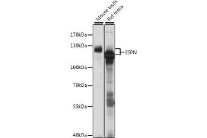Western blot analysis of extracts of various cell lines, using ESPN antibody (ABIN7267008) at 1:1000 dilution. (Espin antibody  (AA 585-854))
