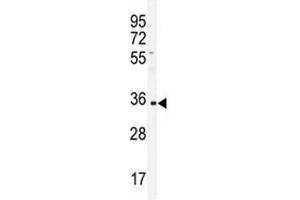 Western blot analysis of IGHA1 antibody and CEM lysate. (IGHA1 antibody  (AA 257-286))