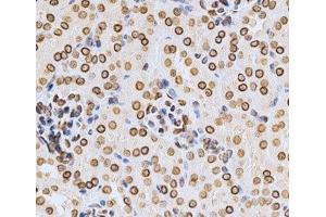 Immunohistochemistry of paraffin-embedded Mouse kidney using Lamin A/C Polyclonal Antibody at dilution of 1:200 (40x lens). (Lamin A/C antibody)