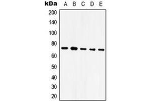 Western blot analysis of GRP75 expression in HeLa (A), NIH3T3 (B), SP2/0 (C), mouse brain (D), rat brain (E) whole cell lysates. (HSPA9 antibody  (C-Term))