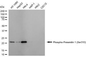 Western blotting analysis using phospho-presenilin 1 (Ser310) antibody (ABIN7799896). (Recombinant Presenilin 1 antibody  (pSer310))