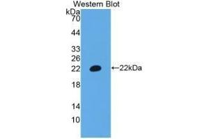 Detection of Recombinant CD3e, Human using Polyclonal Antibody to T-Cell Surface Glycoprotein CD3 Epsilon (CD3e) (CD3 epsilon antibody  (AA 28-185))