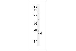 UF Antibody (Center) (ABIN654921 and ABIN2850478) western blot analysis in K562 cell line lysates (35 μg/lane). (ZG16B antibody  (AA 109-137))