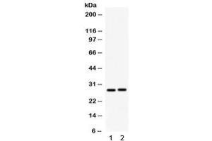 Western blot testing of 1) rat kidney and 2) mouse kidney lysate with IGFBP1 antibody. (IGFBPI antibody)