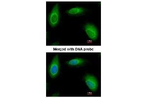 AP19035PU-N Ran BP1 antibody staining of Paraformaldehyde-fixed HeLa by Immunofluorescence at 1/200 dilution. (RANBP1 antibody  (N-Term))